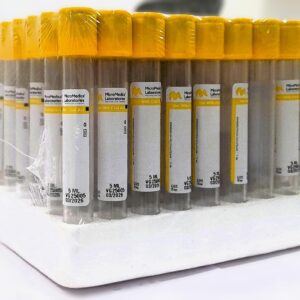Vacuum Blood Collection Tube with Gel
